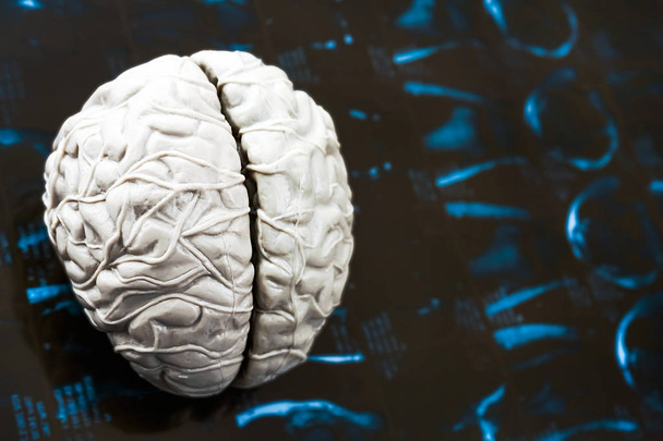 μοντέλο του εγκεφάλου στην ακτινογραφία, αξονική τομογραφία έρευνας - Φωτογραφία, εικόνα