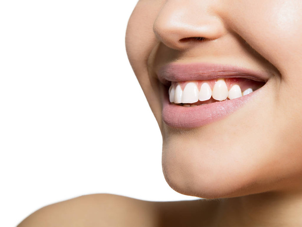 Lachende vrouw mond met grote tanden op witte achtergrond. Hea - Foto, afbeelding