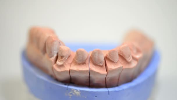 Zahntechniker arbeitet an 3D-gedruckter Form für Zahnimplantate - Filmmaterial, Video