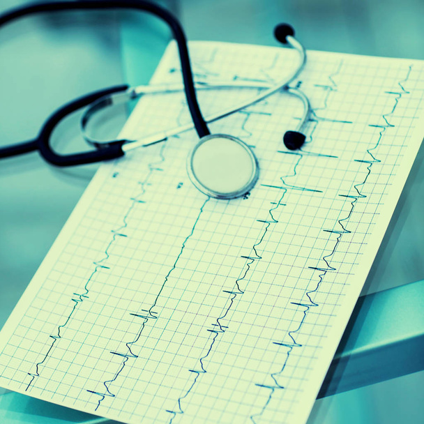  stethoscope and electrocardiogram on the table from the therapist - 写真・画像