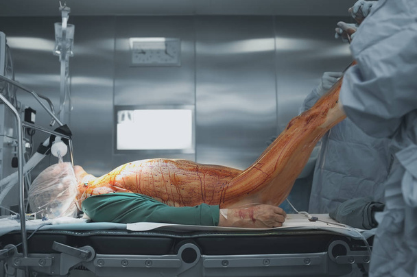 Paziente addormentato sul tavolo operatorio e chirurghi di lavoro in t
 - Foto, immagini
