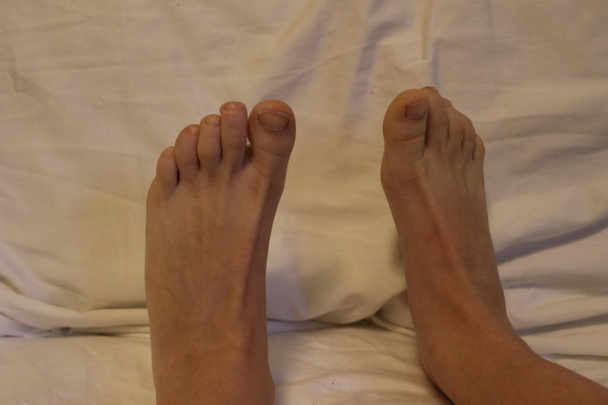 Kinder barfuß. Die nackten Füße der Kinder sind sehr dünn und etwas geädert. weiße Füße. - Foto, Bild