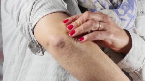 woman with elbow pain, close up - Footage, Video