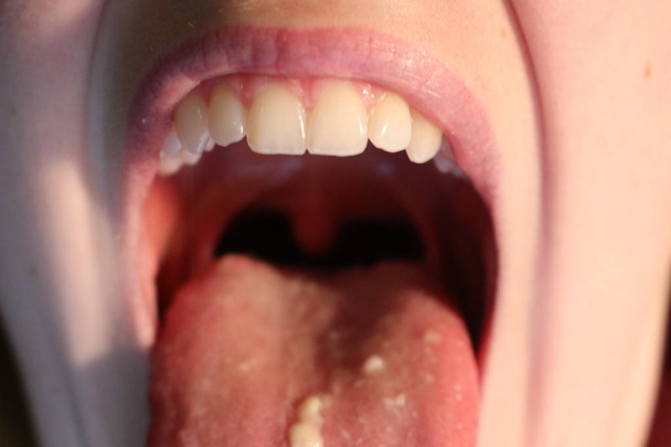Gros plan de dents souriantes isolées pour plus de détails
 - Photo, image