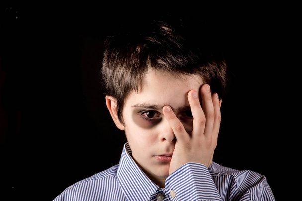 jongen met blauw oog - Foto, afbeelding