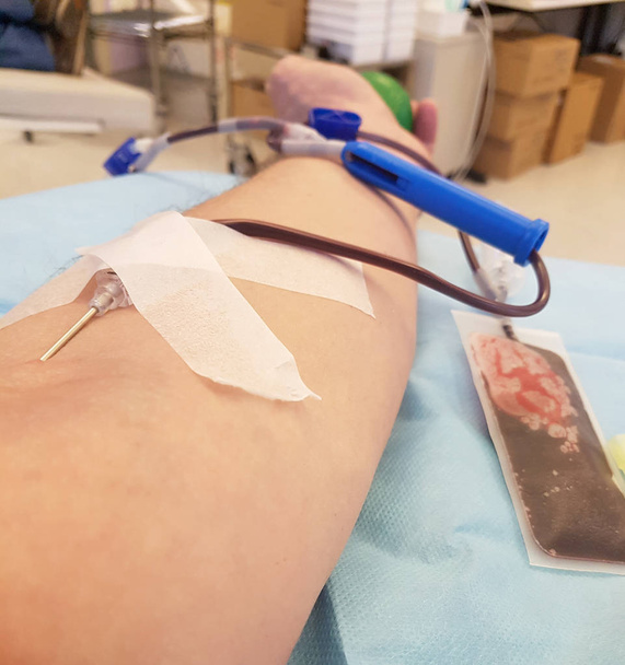 腕と献血中に若いボランティア - 写真・画像