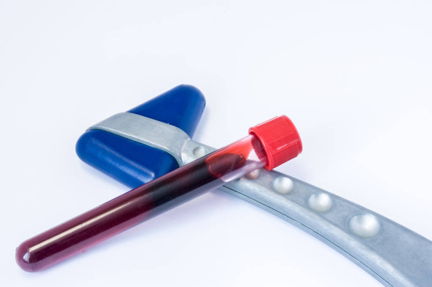 Reagenzgläser mit Blut liegen auf dem neurologischen Gummireflexhammer auf weißem Hintergrund. Labordiagnostik für Erkrankungen des menschlichen Nervensystems - Foto, Bild