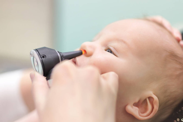Lactente em clínica pediátrica. Mão de médico close-up com otoscópio moderno examinando o nariz do bebê. Saúde das crianças e prevenção de doenças
 - Foto, Imagem
