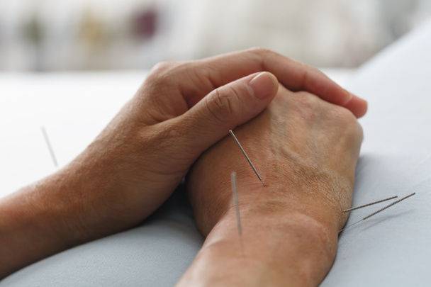 acupuncture - Photo, Image