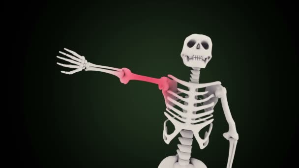 Arm pijn concept op een skelet - Video