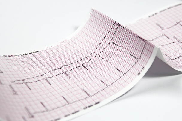 Elettrocardiogramma, elettrocardiogramma cardiaco
 - Foto, immagini