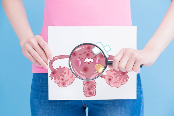 woman with  sick uterus billboard and magnifying on the blue background - Fotoğraf, Görsel