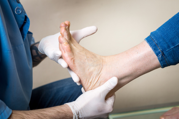 Ręce młodego człowieka lekarz ortopeda prowadzi diagnostykę, test stóp stopy kobiety, do produkcji poszczególnych, Ortopedyczne wkładki - Zdjęcie, obraz