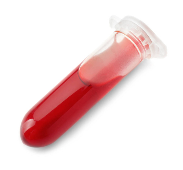 Probówki z próbki krwi na białym tle - Zdjęcie, obraz
