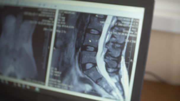 Doktor, hasta MRI makinesinde hareket ederken bilgisayar ekranına bakarak doktor onun laptop manyetik rezonans görüntüleme sonuçlarını analiz eder. 4k, arka plan bulanıklık - Video, Çekim
