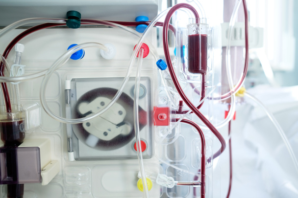 sala de urgencias de cuidados intensivos con máquina de hemodiálisis o hemof
 - Foto, imagen