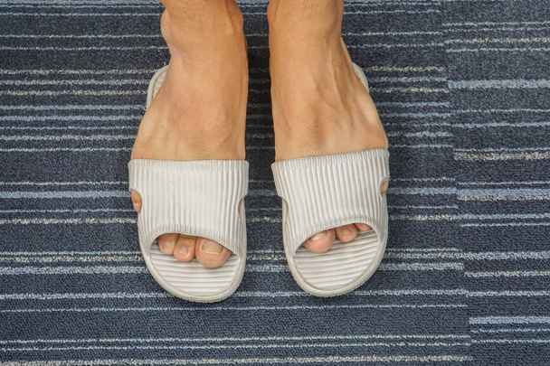 Detailní záběr sandál je příliš těsné pro Pánské nohy dostat do - Fotografie, Obrázek
