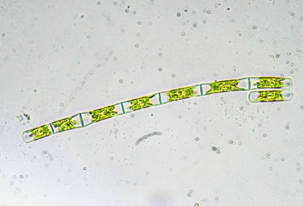 Algen unter dem Mikroskop. die mikroskopische Welt. - Foto, Bild