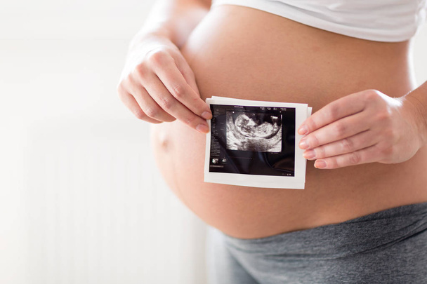 Pregnant woman holding ultrasound photo on her belly - Valokuva, kuva