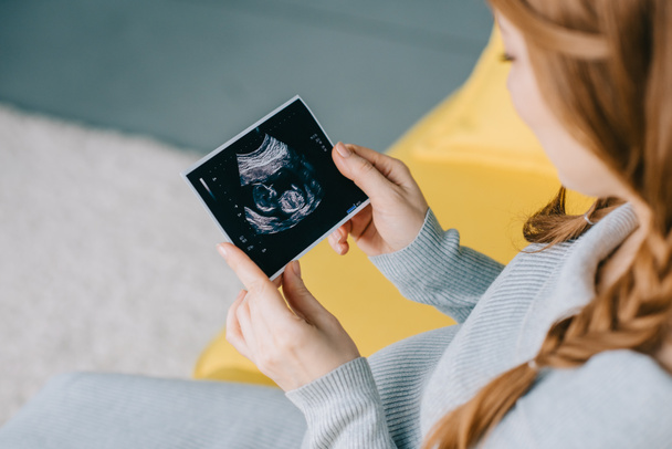 abgeschnittenes Bild einer attraktiven Schwangeren beim Ultraschallbild im Wohnzimmer - Foto, Bild