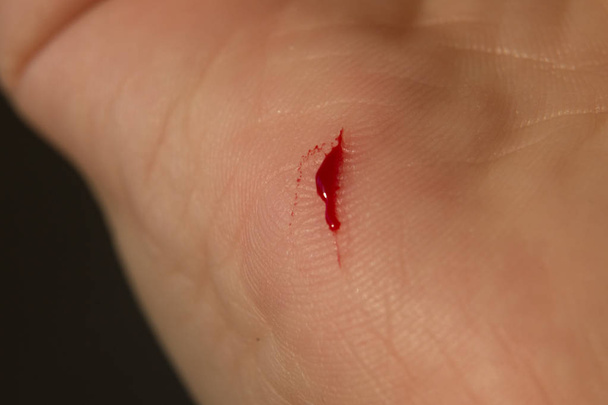 głębokie cięcie powodowane przez nóż w ręku palm - Zdjęcie, obraz