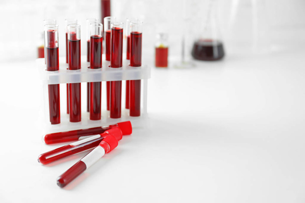 Reagenzgläser mit Blutproben auf dem Tisch - Foto, Bild