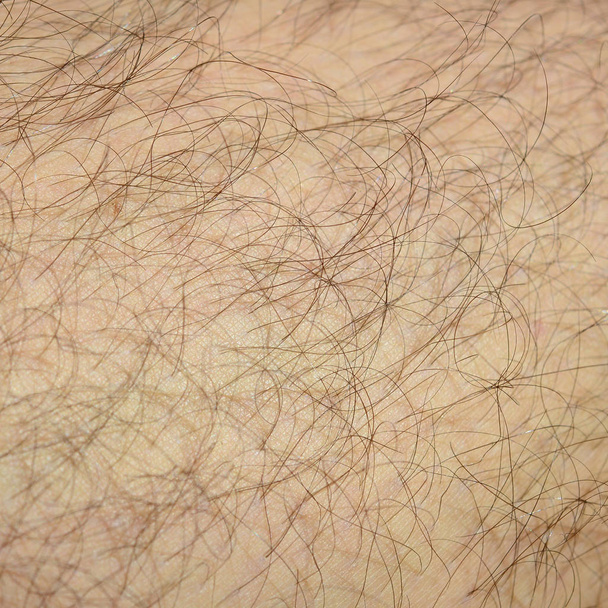 Detalhe fechado de pele humana com cabelo. Mans perna peluda
 - Foto, Imagem