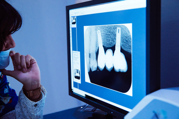 vrouw tandarts observeren en een röntgenfoto van mond te wijzen op de co - Foto, afbeelding