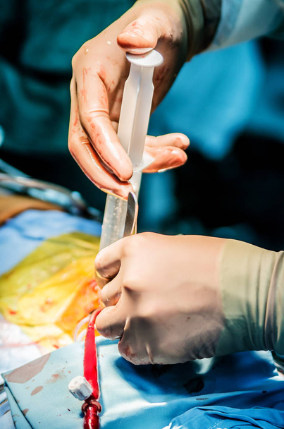 外科医は、バルブの能力をチェックするために手術中に心室に食塩水を注ぐ. - 写真・画像