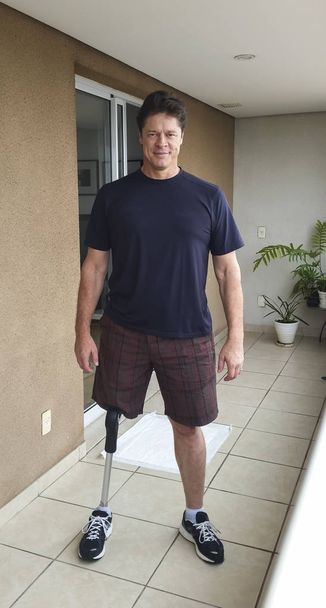 Man van middelbare leeftijd met fysieke, leunend op zijn prothese  - Foto, afbeelding