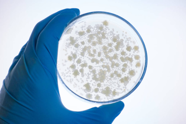 A hand in a glove holds a petri dish. Colonies of bacteria on a petri dish on translucence in white light. Analysis of bacterial colonies on a petri dish. - Photo, Image