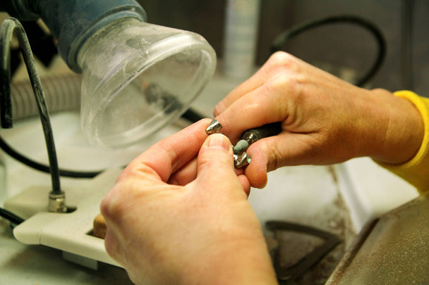 Mains de technicien dentaire traitant prothèse orale en métal
 - Photo, image