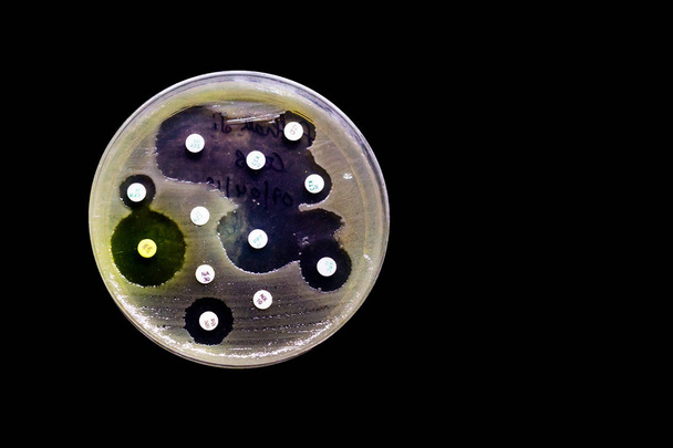 Plaque de culture de croissance bactérienne montrant une sensibilité aux antibiotiques dans leur patron de colonie isolée en fond noir
 - Photo, image