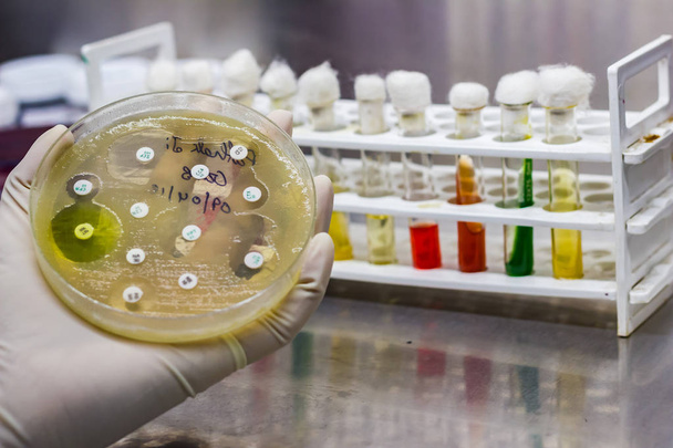 Vista laterale della Piastra di coltura di crescita batterica mostrando sensibilità antibiotica nel loro modello di colonia posto geld in mano guantata
 - Foto, immagini