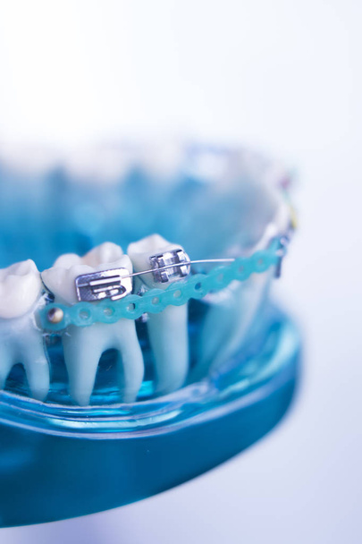 Dents dentaires supports métalliques
 - Photo, image
