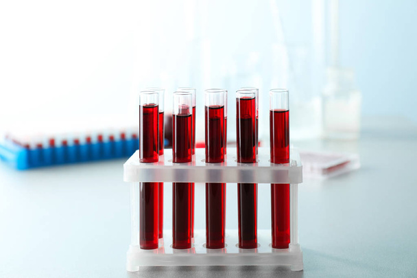 Tubos de ensayo con muestras de sangre en el soporte de la mesa
 - Foto, imagen