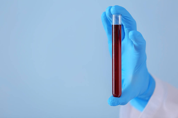 Trabajador de laboratorio sosteniendo tubo de ensayo con muestra de sangre sobre fondo de color
 - Foto, Imagen