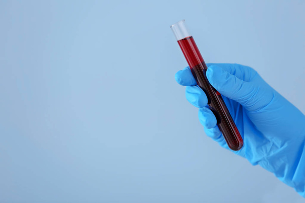 Lab worker holding test tube with blood sample on color background - Photo, Image