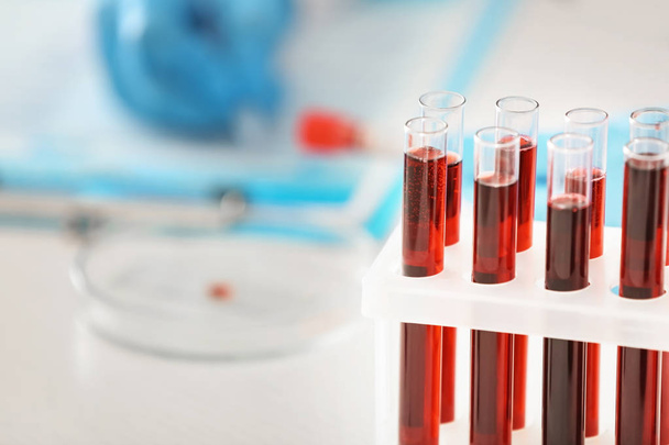 Reageerbuisjes met bloedmonsters in houder en wazig lab werknemer op achtergrond - Foto, afbeelding