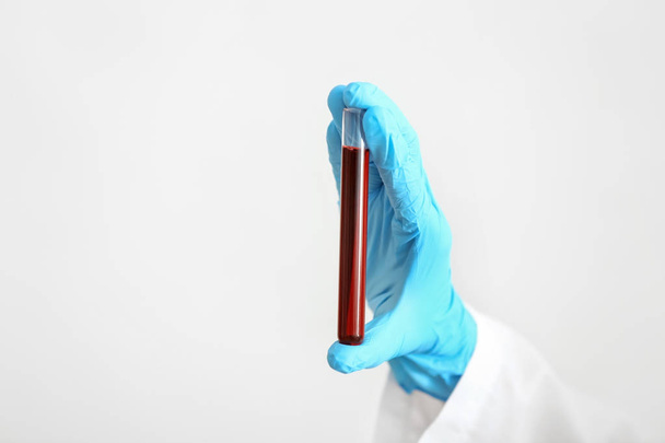 Tüp kan örneği ile beyaz arka plan üzerinde tutarak laboratuar işçisi - Fotoğraf, Görsel