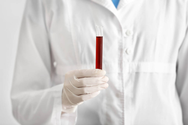 Mujer sosteniendo tubo de ensayo con muestra de sangre, primer plano
 - Foto, imagen