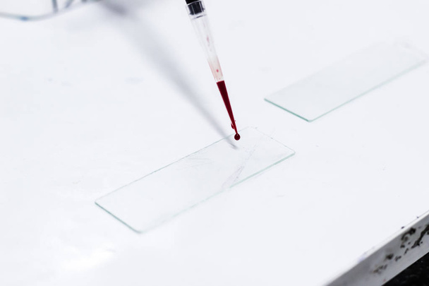 σταγόνα αίματος σε ένα γυάλινο πλακίδιο χρησιμοποιώντας Μικροπιπέτα microtip - Φωτογραφία, εικόνα