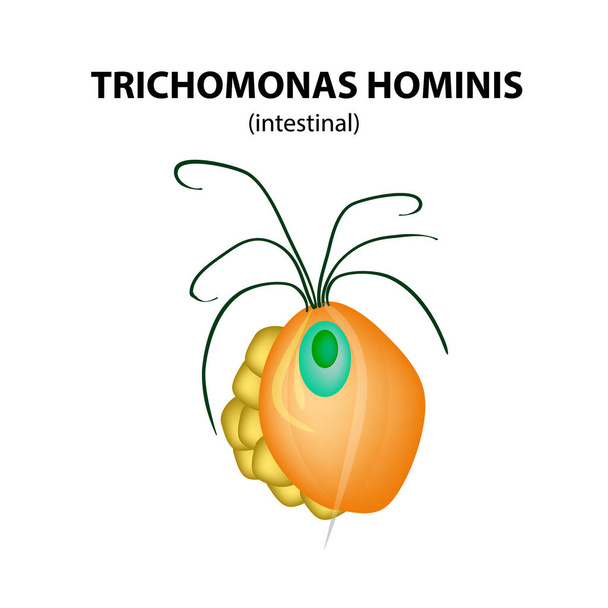 Trichomonas structure intestinale. Trichomonase. Infection urogénitale. Infographie. Illustration vectorielle sur fond isolé
. - Vecteur, image