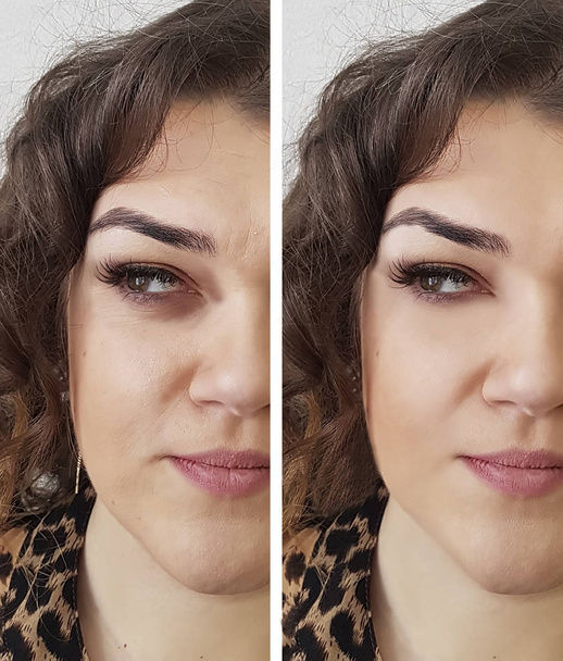 mulher rugas diferença antes e depois
 - Foto, Imagem