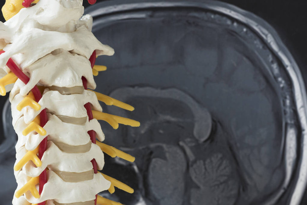 Modello di colonna vertebrale cervicale umana e immagine della risonanza magnetica cerebrale
 - Foto, immagini