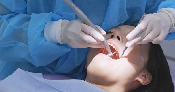 Mujer sometida a revisión dental
  - Foto, Imagen