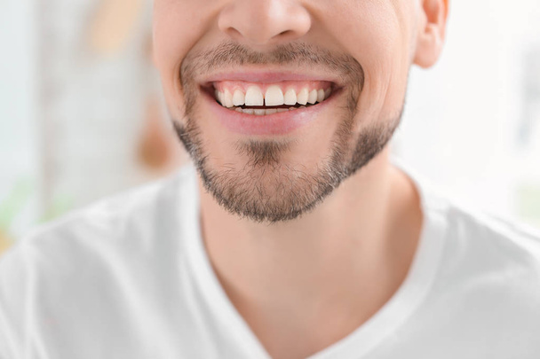 Young man with beautiful smile indoors. Teeth whitening - Zdjęcie, obraz