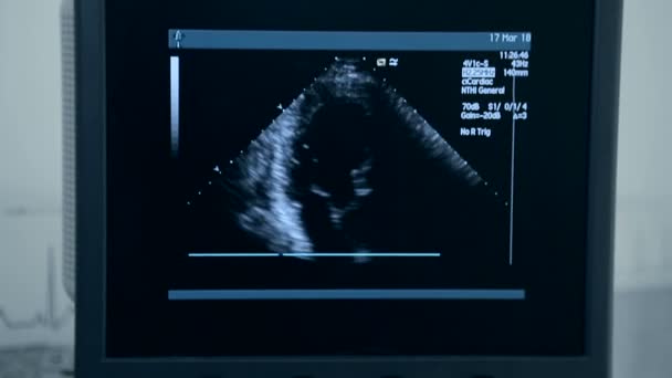 Máquina de ultra-som com monitor. Exame do coração
 - Filmagem, Vídeo