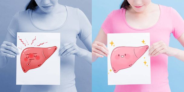 healthy and unhealthy   liver  billboards.  health concept  - Фото, изображение