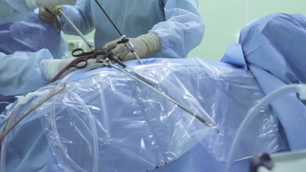 Laparoskopowa Chirurgia jamy brzusznej - Materiał filmowy, wideo